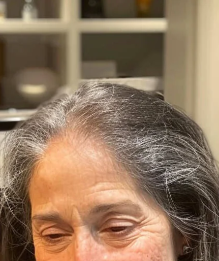 Michelle K. before using TheraBrush