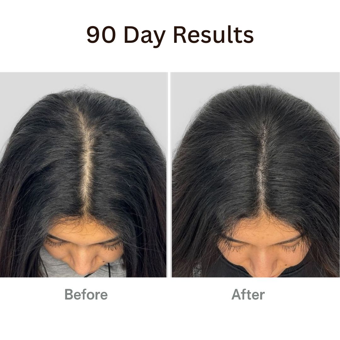 TheraBrush™ + Hair Tonic