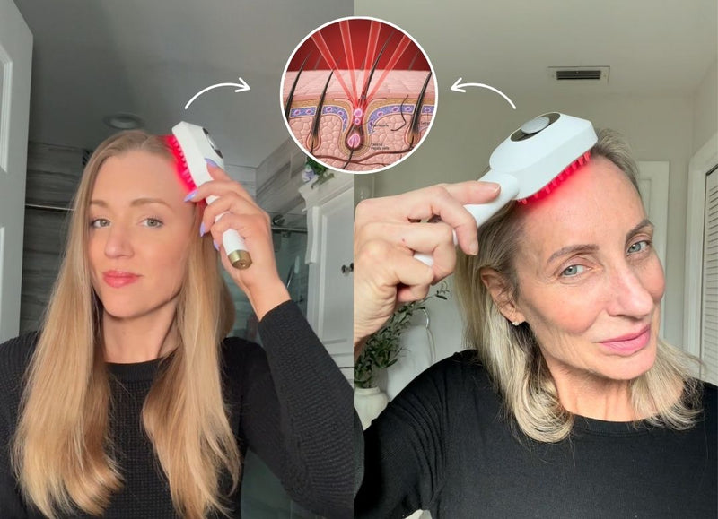 650nm Red Light Therapy: The Gold Standard for Hair Growth