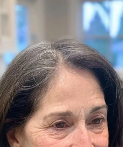 Michelle K. customer progress photo