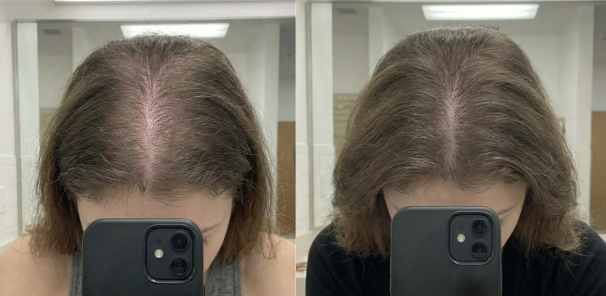 Results in 90 Days