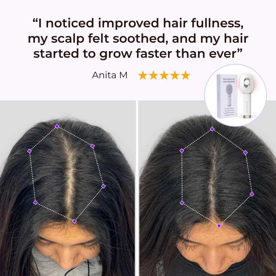 TheraBrush® The Natural 4in1 Hair Restoring Brush