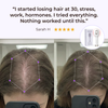 TheraBrush® The Natural 4in1 Hair Restoring Brush