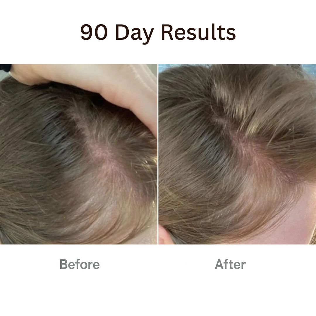 TheraBrush™ + Hair Tonic