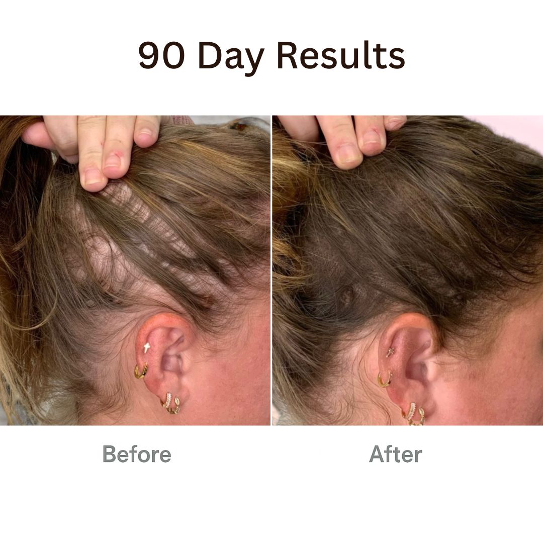 TheraBrush™ + Hair Tonic