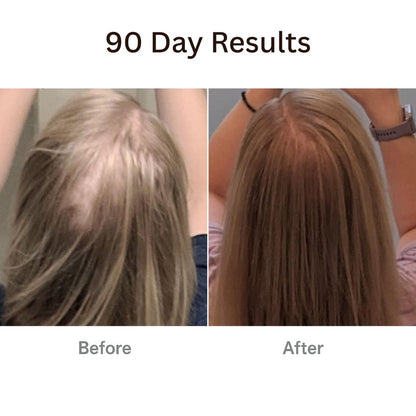 TheraBrush™ + Hair Tonic
