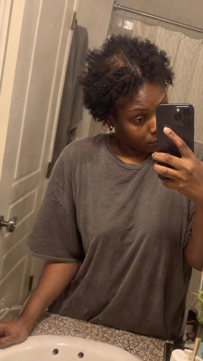 Before photo from TheraHair customer gallery