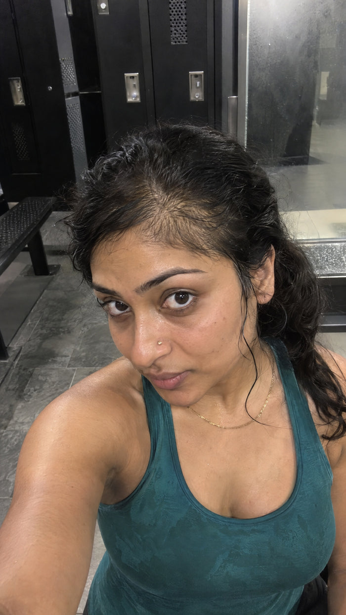 Before photo from TheraHair customer gallery