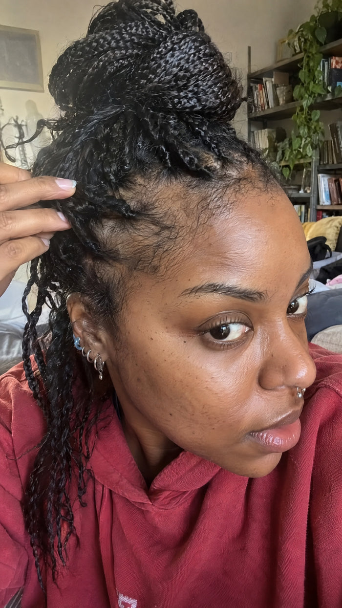 TheraHair customer before photo