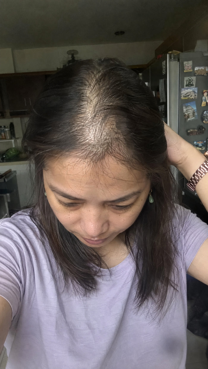 Visible scalp before a customer’s hair-care journey