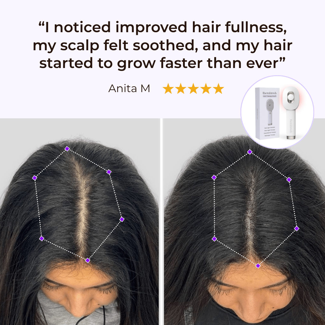 TheraBrush® The Natural 4in1 Hair Restoring Brush