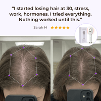 TheraBrush® The Natural 4in1 Hair Restoring Brush