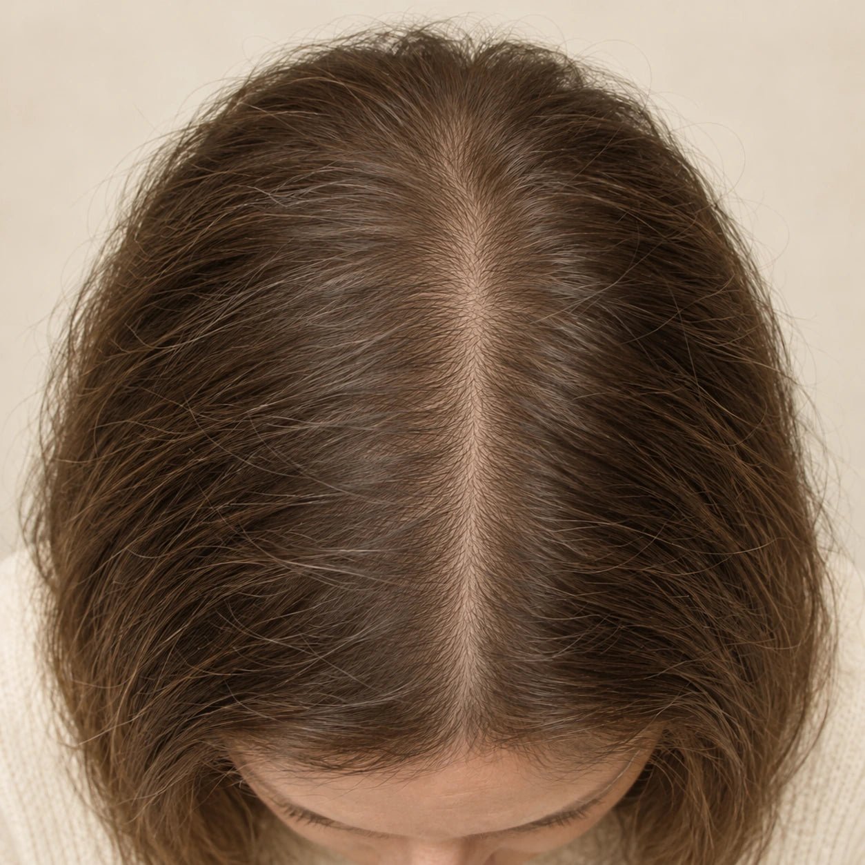 AI illustration of hair density at hypothetical week 16